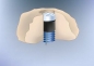 Quellstein Brunnenstein Marmorstein ab 8,25 Kg Durchmesser innen 21 mm
